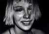 пчела укусила